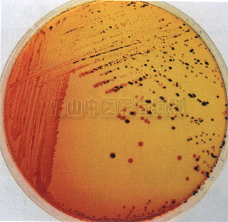 伤寒沙门菌在ss琼脂平板上的菌落特征