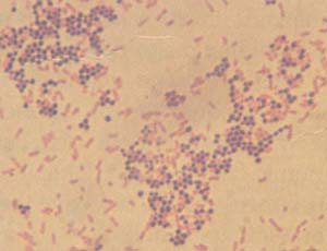 革兰氏染色的金黄色葡萄球菌和大肠杆菌